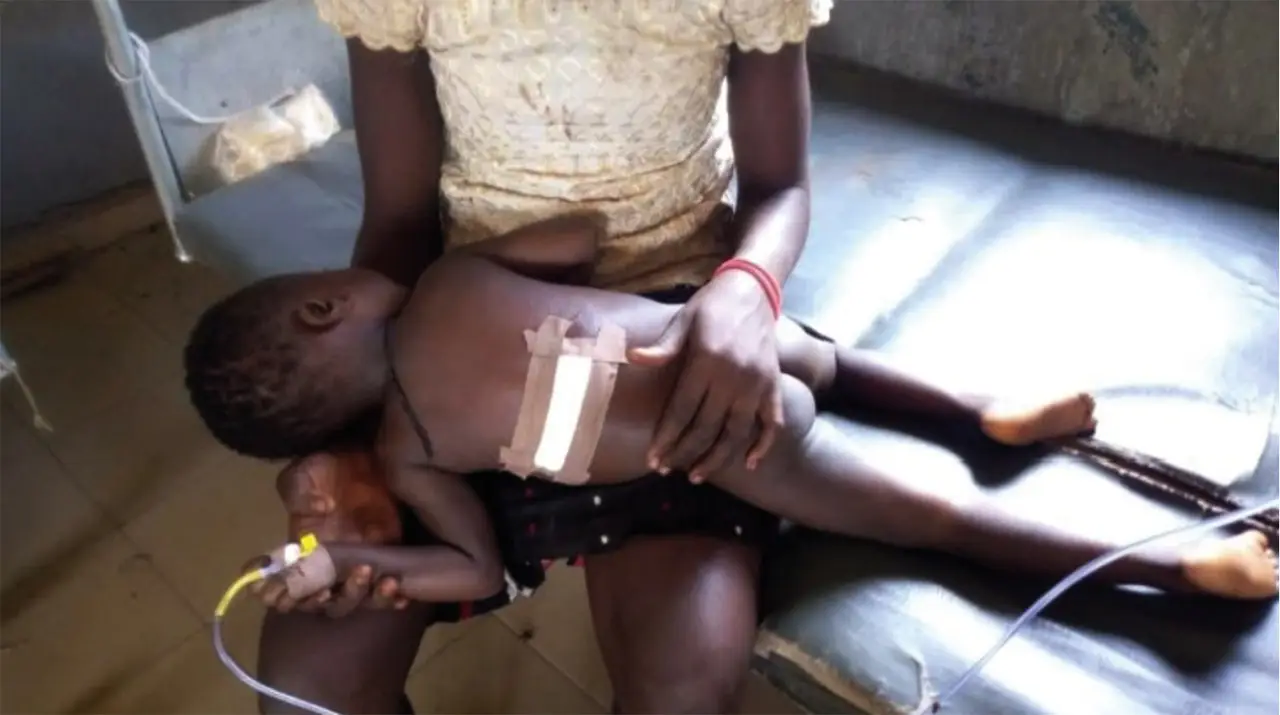 A child receiving treatment (photo courtesy of BZN)